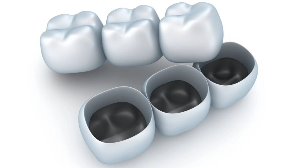 Canva Artificial tooth crowns scaled 1