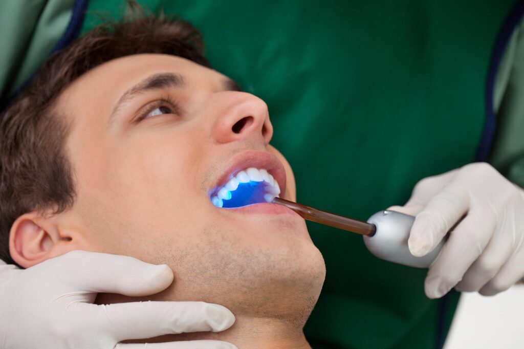Dental Bonding